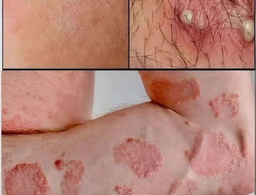 These are the signs that he is cr… See more… See more