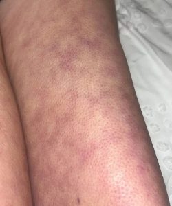 These are the consequences of sleeping with the…