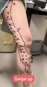 Important Signs from Your Body That Should Not Be Overlooked