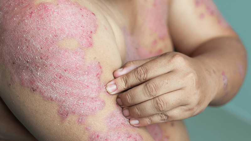 .These are the consequences of sleeping with the…